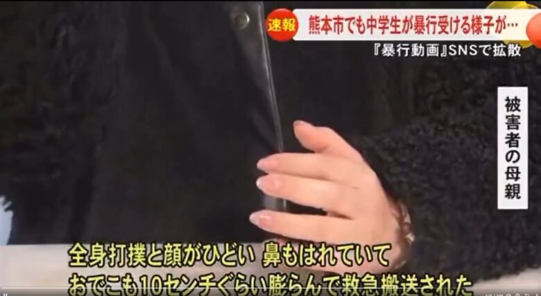 ニュース画像３